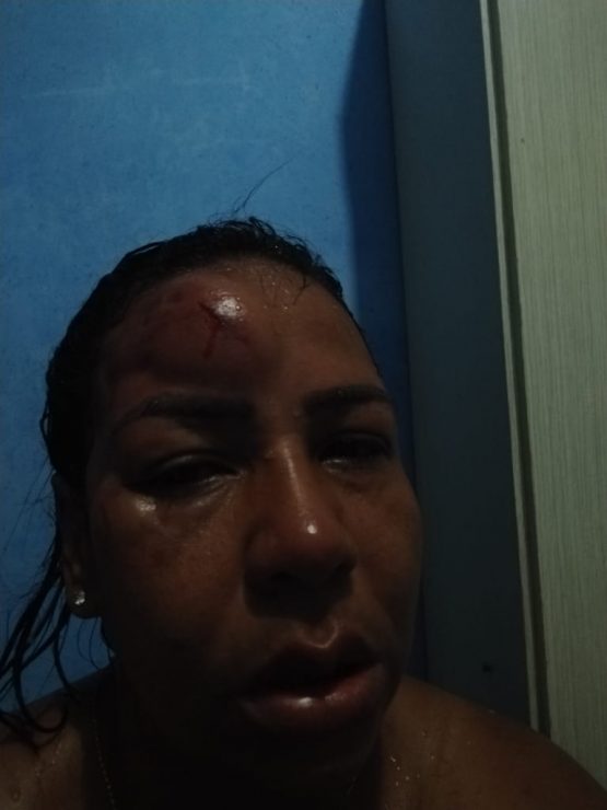 A mulher completamente ferida no rosto.