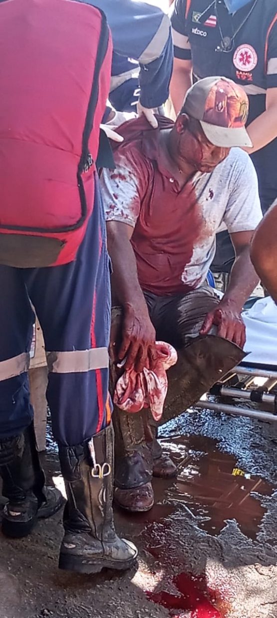 Homem ficou molhado de sangue.