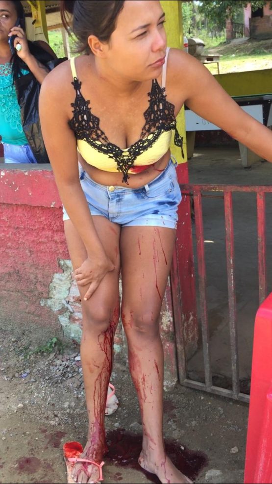 Vítima aguardou a chegada da ambulância.