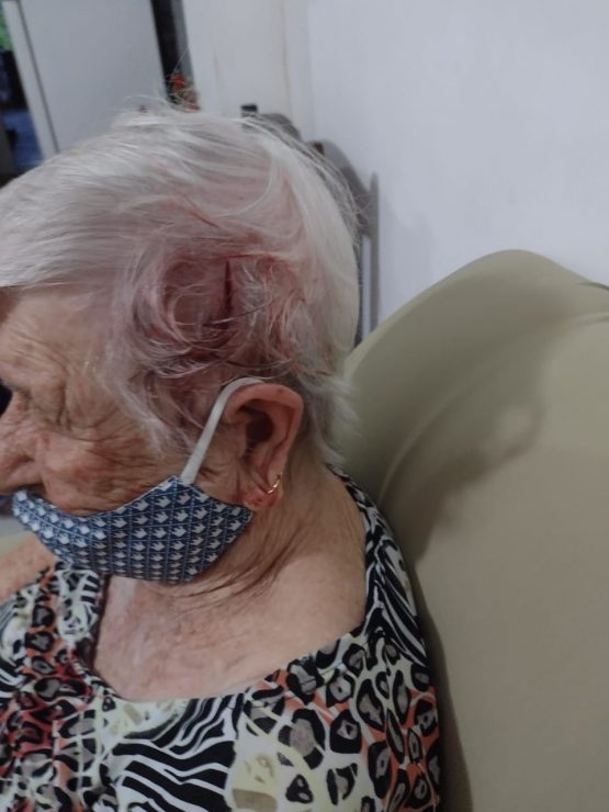 Idosa com a cabeça ferida.