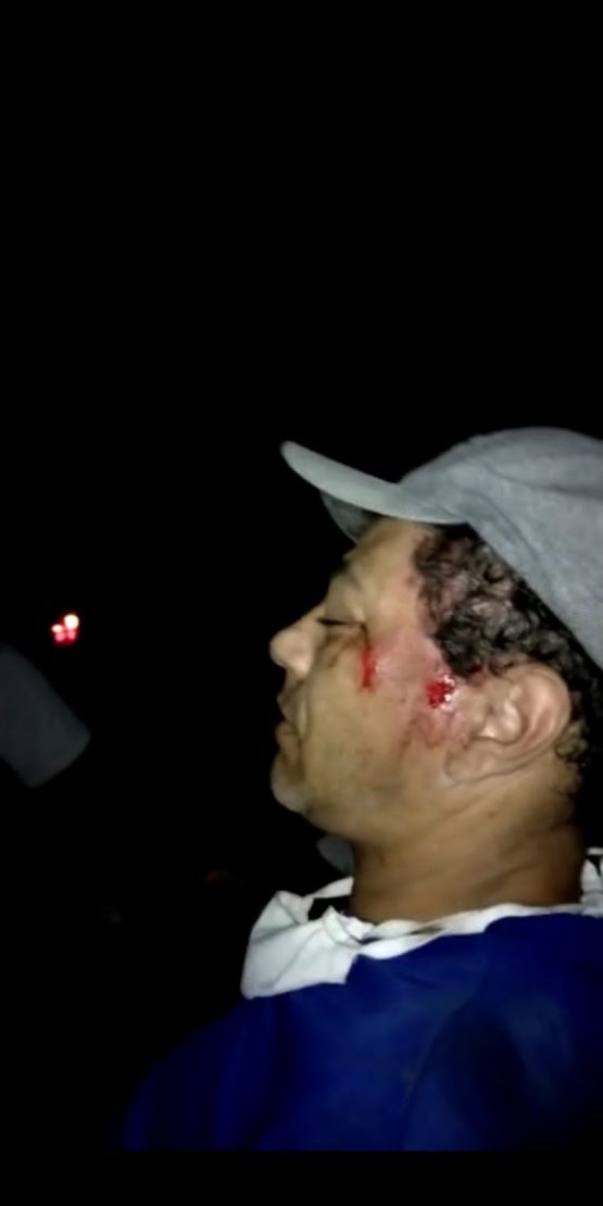 Idoso ficou com a cabeça ferida.